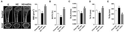 Bovine Milk Extracellular Vesicles Are Osteoprotective by Increasing Osteocyte Numbers and Targeting RANKL/OPG System in Experimental Models of Bone Loss